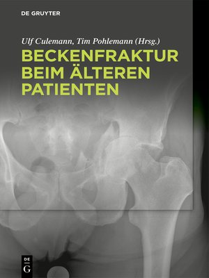 cover image of Beckenfraktur beim älteren Patienten